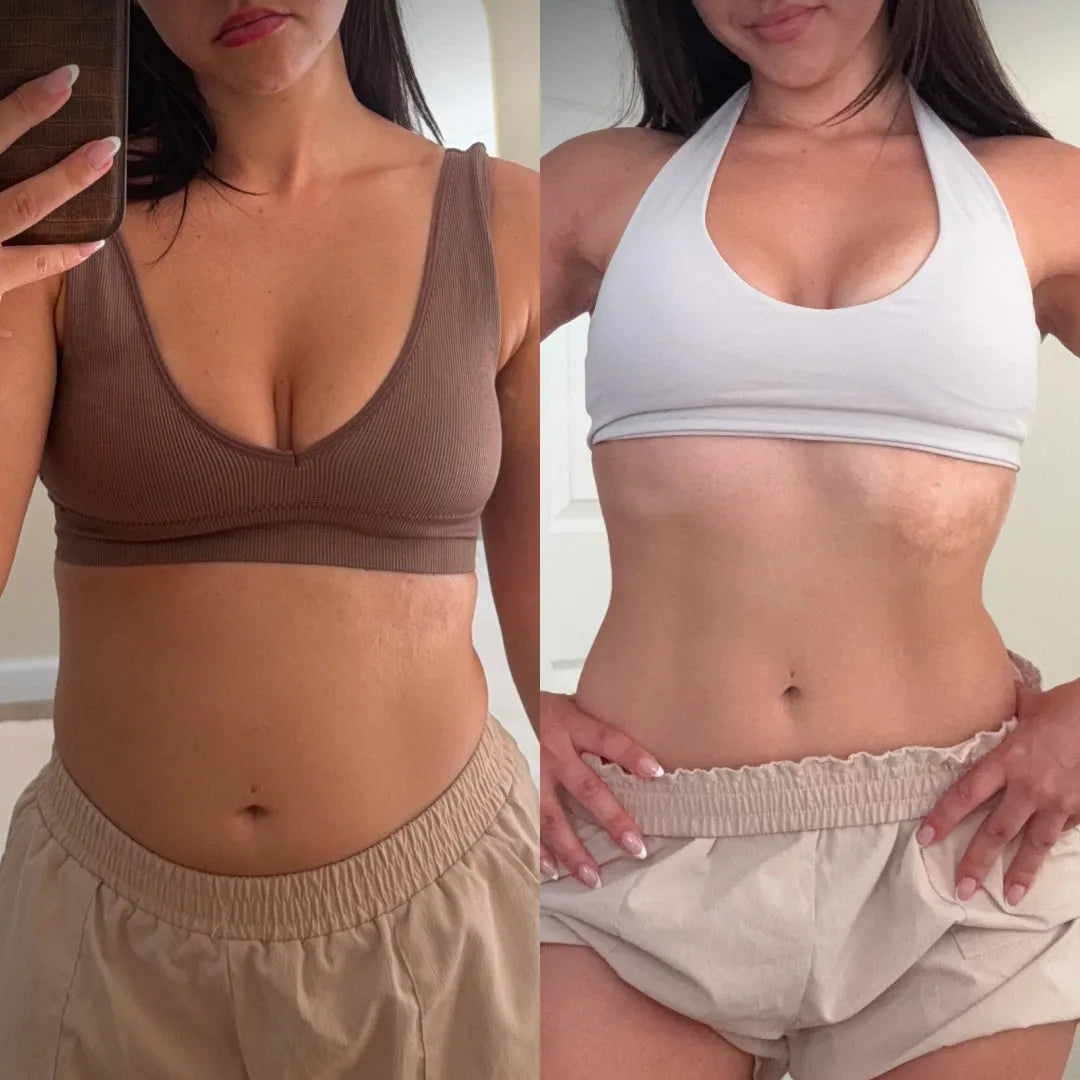 Seraviva BodySculpt | Moldeador Corporal 3 en 1