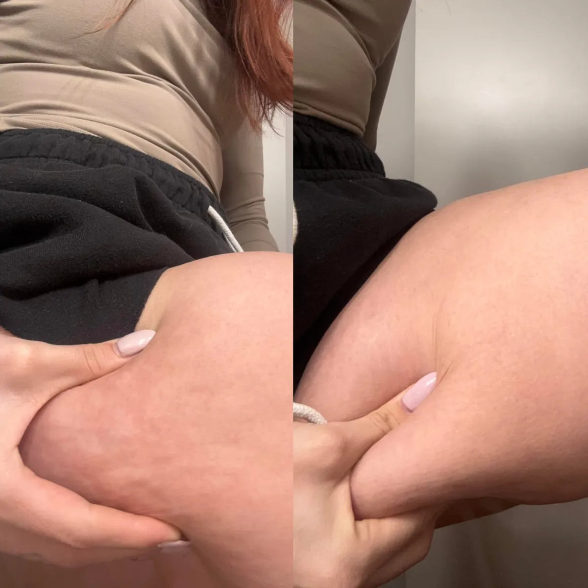 Seraviva BodySculpt | Moldeador Corporal 3 en 1